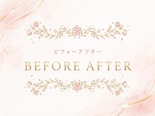 ミニョン(mignon)/ビフォーアフター