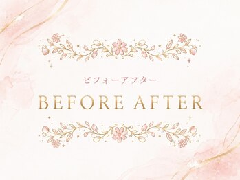 ミニョン(mignon)/ビフォーアフター