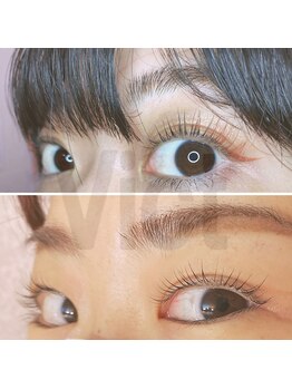 ビクト(Vict)/がっつりあげも超カワイイです☆