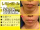オンリーホープ(ONLY HOPE)の写真