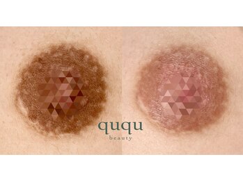 クク(ququ)/【バストトップ】ローマピンク