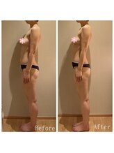 オクノマ(OKUNOMA)/【全身美背骨BeforeAfter】