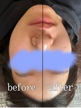 4515/お客様Before After