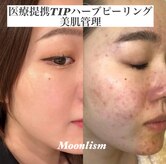ムーンリズム(Moonlism)