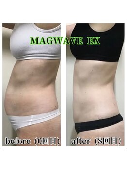 ロゼッティ(ROSETTY)/痩身/マグウェーブ/筋トレ