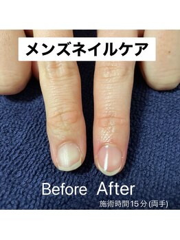 ネイキッドベージュ 麻布十番店(Naked Beige)/メンズネイルケア★ビフォアフ
