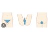 【脱毛】(担当者女性です)メンズVIO光脱毛＋シェービング