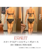 エスプリ 銀座店/アーユルヴェーダスロータス