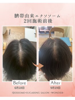 ワンダー(Wonder)/効果実感!40代からの艶髪貯金★