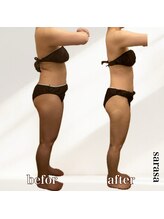 ナチュラル ビューティー スタイル さらさ(Natural Beauty Style)/さらさ痩身プログラム3カ月後