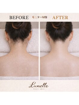 ルネル(Lunelle)/背中までぬかりなく☆