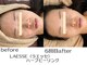 エスポワール(espoir)の写真/韓国大人気〈艶肌〉ララピール5800円〈ニキビ・赤み〉ハーブピーリング5800円同時に毛穴洗浄追加◎