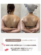 凰湖/ブライダルケア（1回での変化）