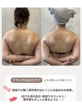 凰湖/ブライダルケア（1回での変化）