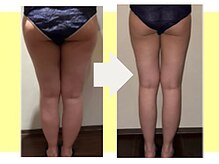 ビオール 新宿店(beall)の雰囲気（脚は最新機器で最短結果出し！！脚/セルライト／痩身）