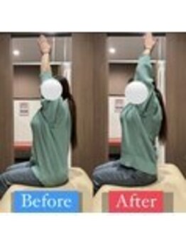 ナオル整体 宮崎院(NAORU整体)/30代女性施術事例【可動域改善】