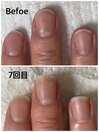 お客様のビフォーアフター写真