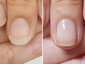 自爪育成/白い部分をピンクに