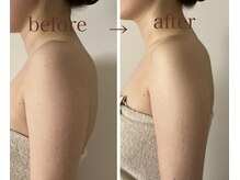ナチューラ(Natura)の雰囲気（☆美しい姿勢矯正☆一度の施術で嬉しい猫背改善♪）