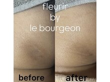 ルブルジョン(le bourgeon)/ローマピンク　ヒップ