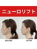 〈¥16,500〉ニューロリフト 30分