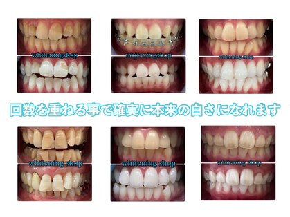 ホワイトニングショップ 西尾店の写真
