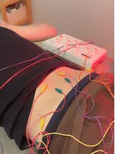 モッチ 天神大名店(MOCCHI)/腰の鍼治療