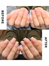リミズネイルビューティー 名駅店(RimisNailxbeauty)/深爪・噛み爪改善