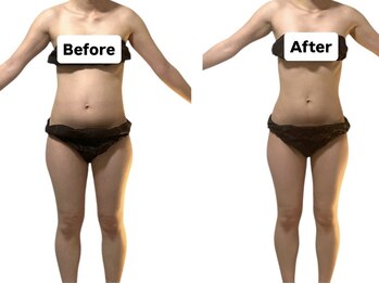 ヨサパーク アリー 湘南台(YOSA PARK ARI)/結果重視