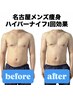 男性人気No.1★【痩身】上半身すっきり◎ハイパーナイフ2部位 60分 ¥8,800