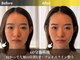 ルーツ 武蔵小杉(R∞ts)の写真