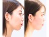 【面長/顎の長さが気になる方】への短期集中改善小顔プログラム 30分初回体験