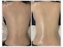 ミューベル(MYubelle)の雰囲気（韓国肌質改善・水光ピール・フェイシャルボディケア・マッサージ）