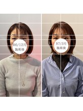 トイ鍼灸接骨院(TOY鍼灸接骨院)/●美容鍼灸