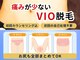 リムーブ(REMOVE)の写真