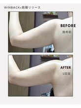 ラグーン(Lagoon)/WINBACK×筋膜リリース