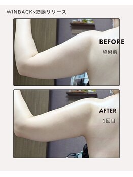 ラグーン(Lagoon)/WINBACK×筋膜リリース