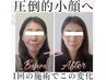 【8月限定☆夏の老け顔解消】-5歳若見えを叶えるリフトアップ小顔矯正 ¥4,500