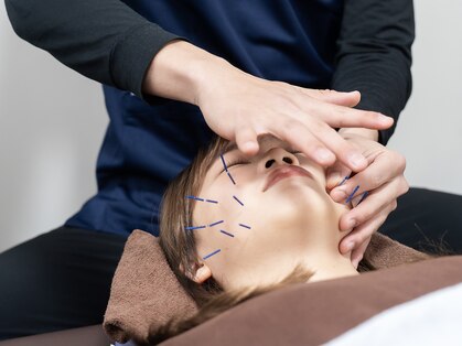 ゼロール鍼灸整体院(ZEROLE鍼灸整体院)の写真