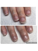 ティアラ(Tiara)/最強のネイルケアメゾット