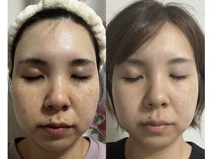 ビー イオンモール小山店(Be...)の写真