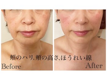 サブリエ(Sablier)/60代前半