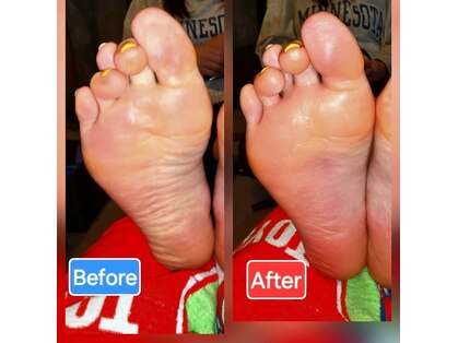 足つぼまーさんの写真