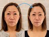 リピ率No.1◎重力たるみを美顔ケア&ほうれい線&二重顎も◎￥20,000⇒￥13,000