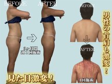 スピード美人 新宿店の雰囲気（男性も大歓迎！痛みの先のスッキリ感♪時短で結果のエステサロン）