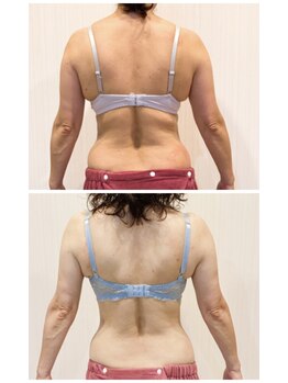 ソラ(sora)/年齢によるバスト悩みを解決★