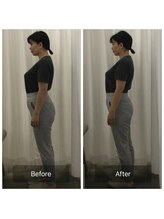 美容整体プラスフィール 恵比寿本店/姿勢矯正・猫背改善