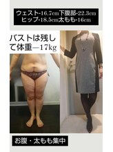 レナトゥス 銀座(Renatus)/二の腕3回結果【痩身/銀座】