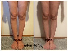 サロン ド アール(salon de R.)/【脚足骨氣・40代・施術効果】