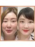 整形級？！目や鼻がお肉に埋もれてない？顔が綺麗になると気持ちも元気♪
